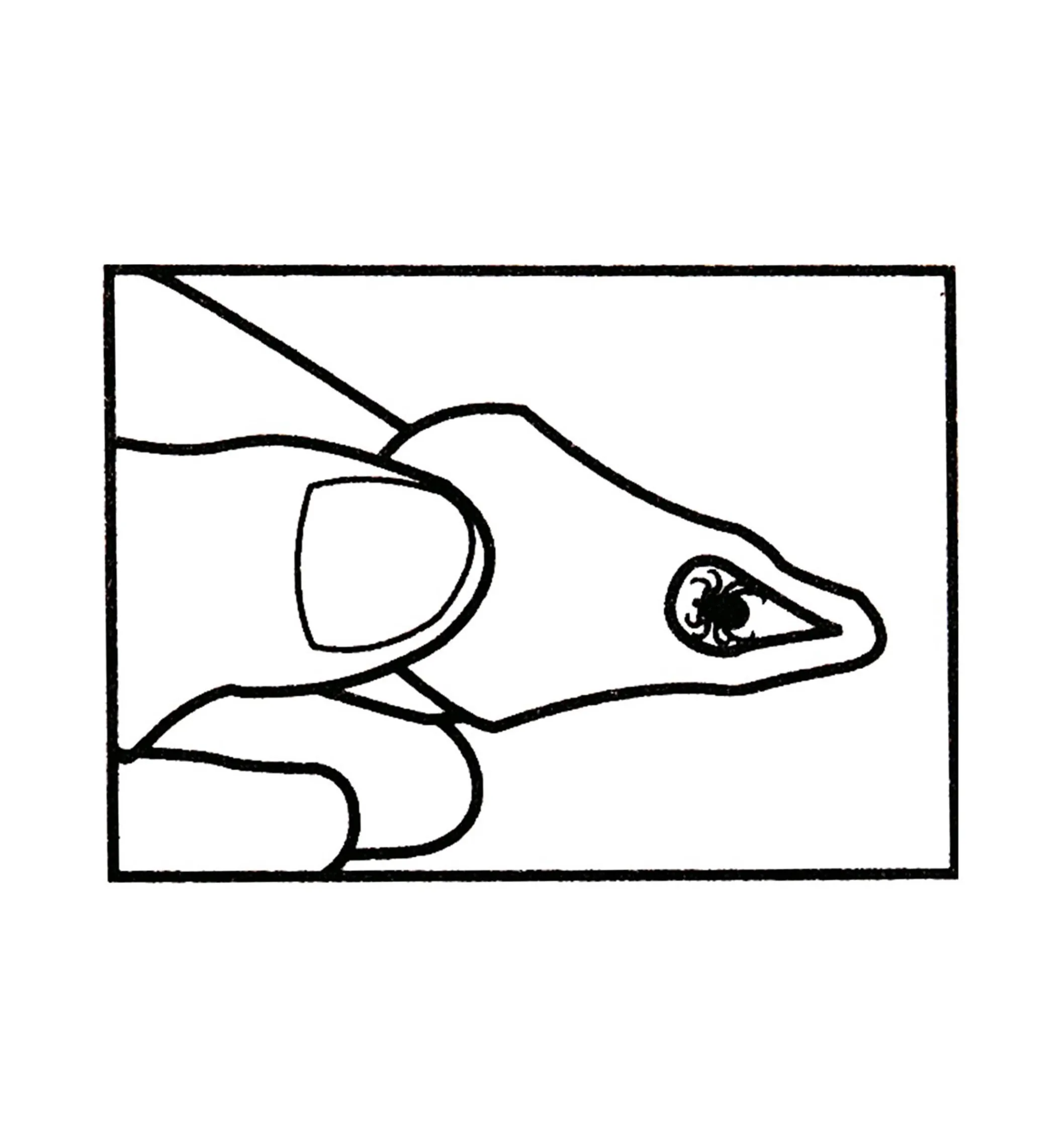 Set Of 3 Tick Key Tick Removers