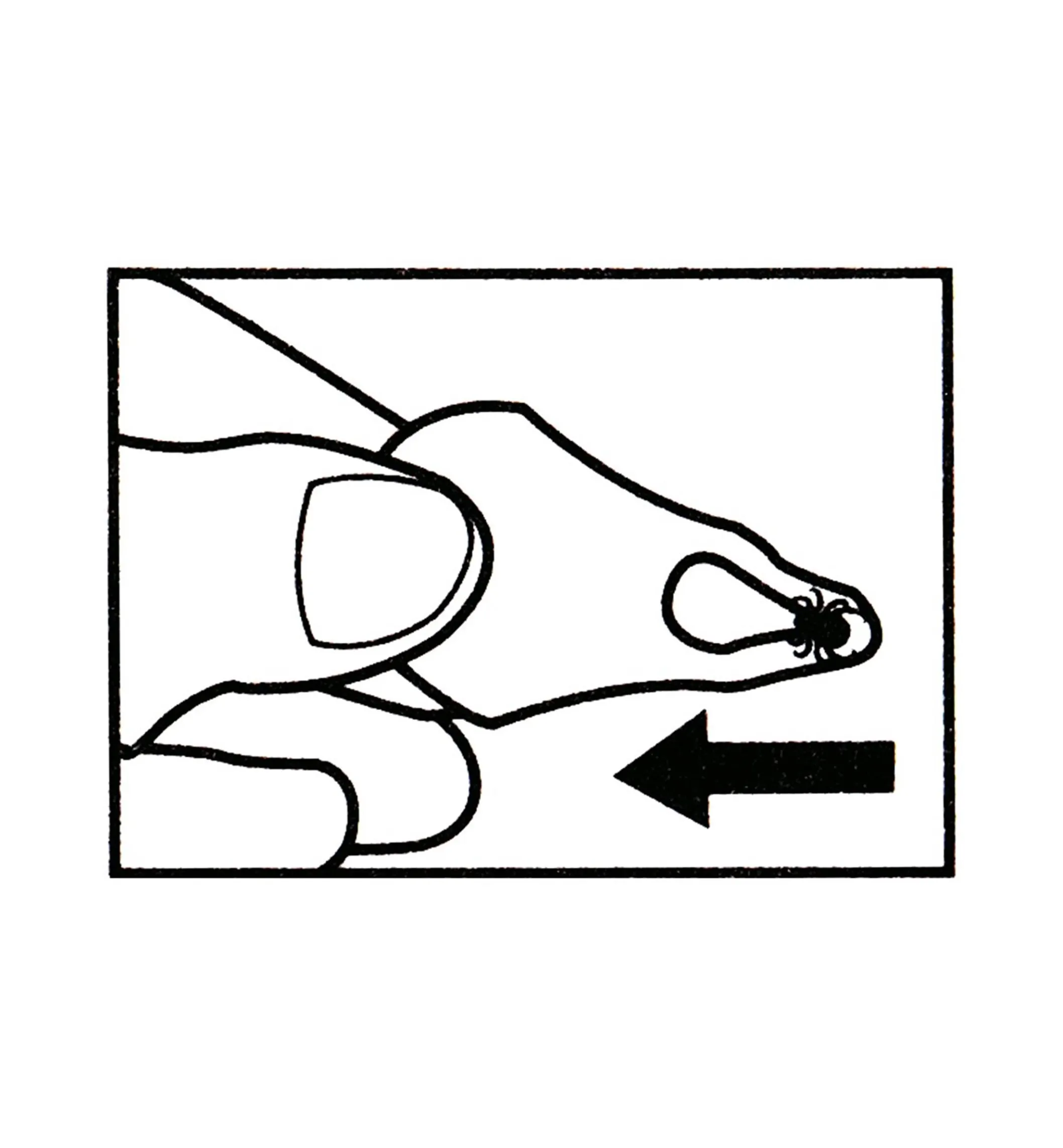 Set Of 3 Tick Key Tick Removers