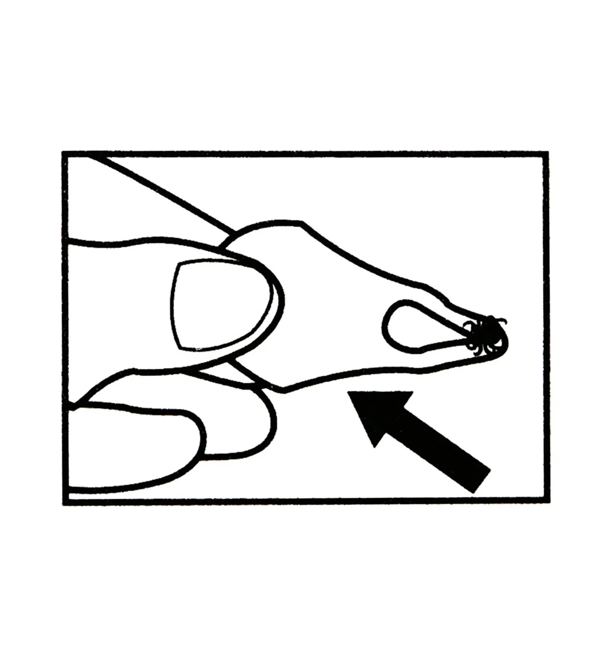 Set Of 3 Tick Key Tick Removers