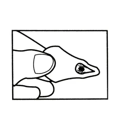 Tick Key Tick Remover