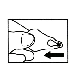 Tick Key Tick Remover